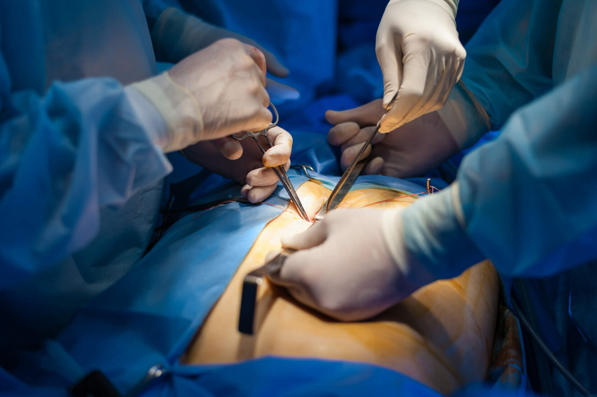 Blog Private General And Ugi Surgeon Mr Achal Khanna Milton Keynes
